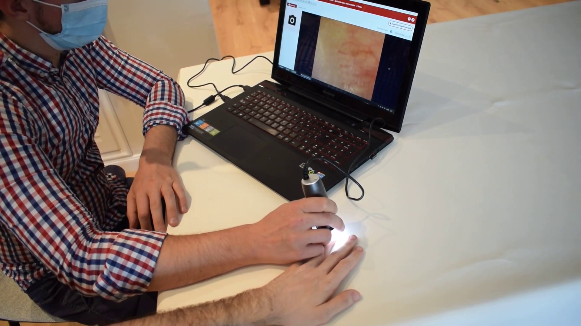 Capillaroscopy procedure - The capillaries at the base of the nails are observed using a portable USB microscope connected to the computer.