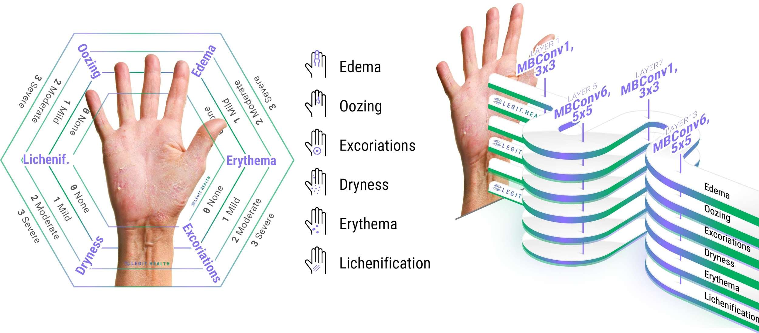 This new clinically developed dermatology artificial intelligence will help you document 232 skin pathologies.