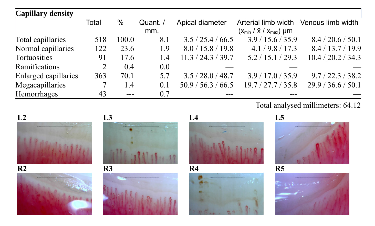 A capillaroscopy report by Capillary.io