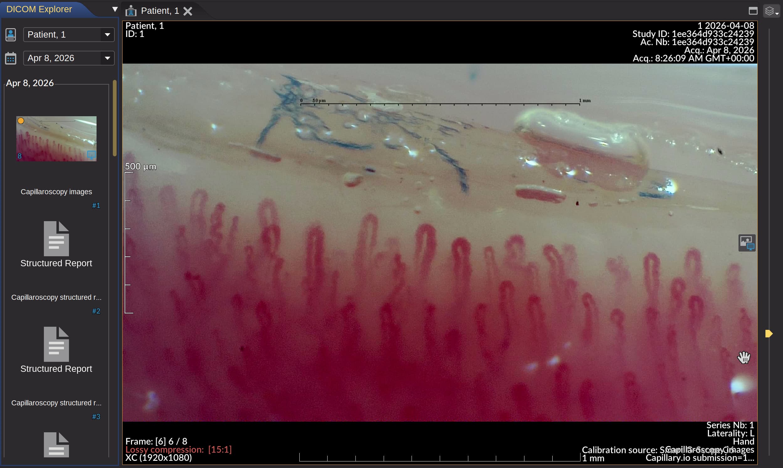 Download DICOM ZIP exports from capillaroscopies and patient capillaroscopy series when you need interoperable imaging files for clinical systems or long-term archiving.