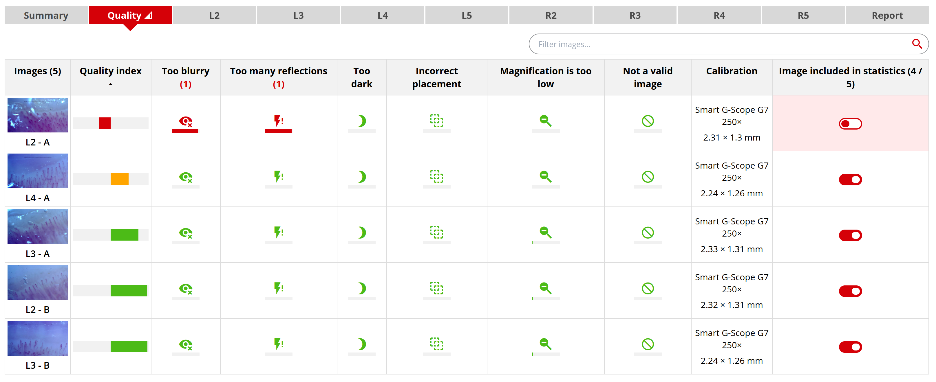 Capillary.io automatically analyzes the quality of your images and points out the most common issues found in capillaroscopy images.