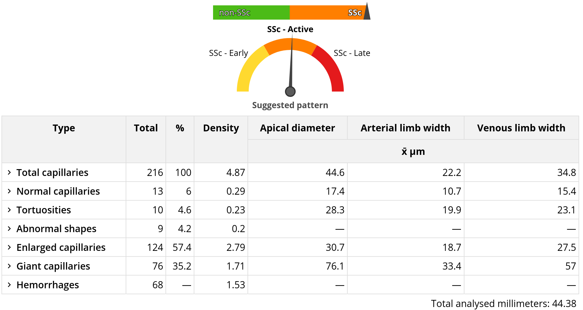 CAPI-Detect is a state-of-the-art algorithm for the classification of capillaroscopic patterns with AI.