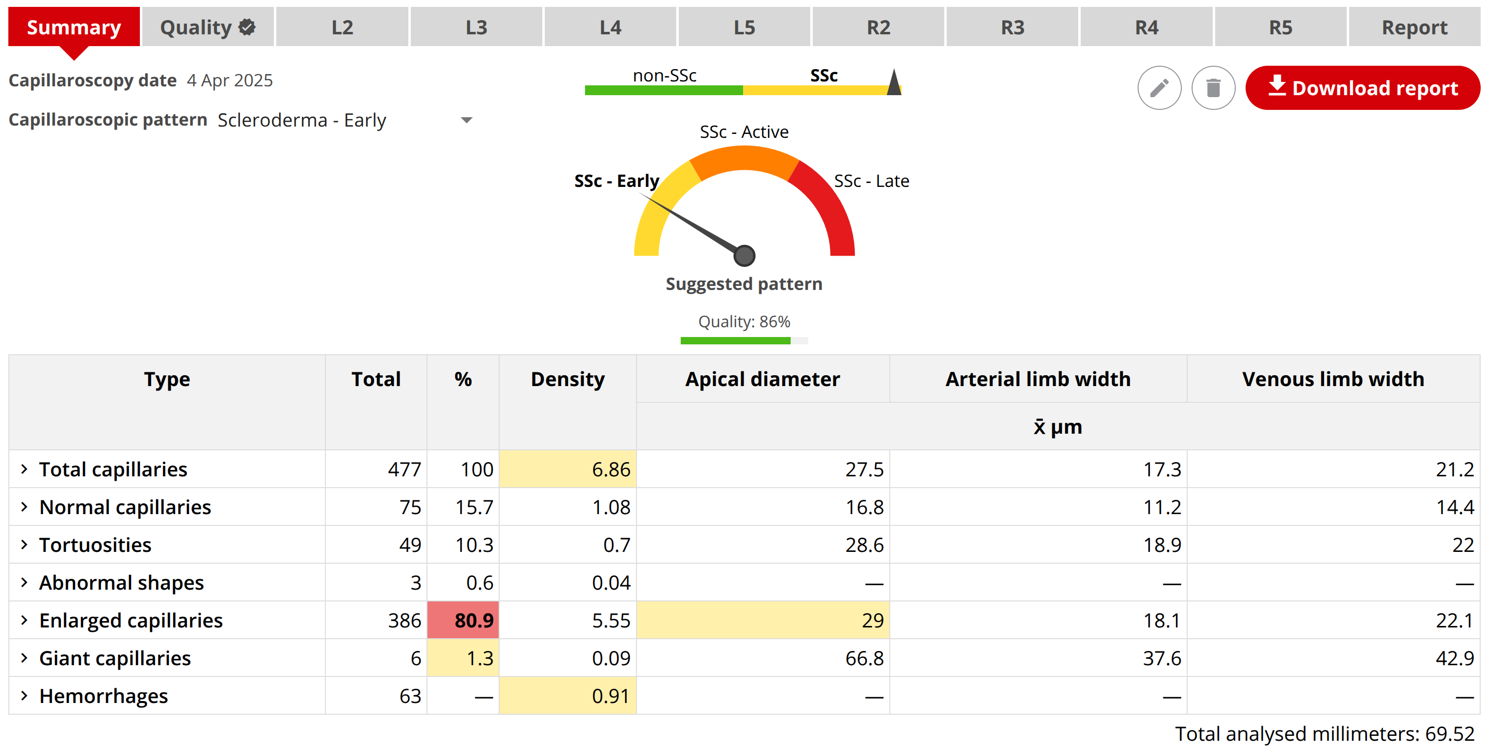 Capillaroscopy summary at Capillary.io web application
