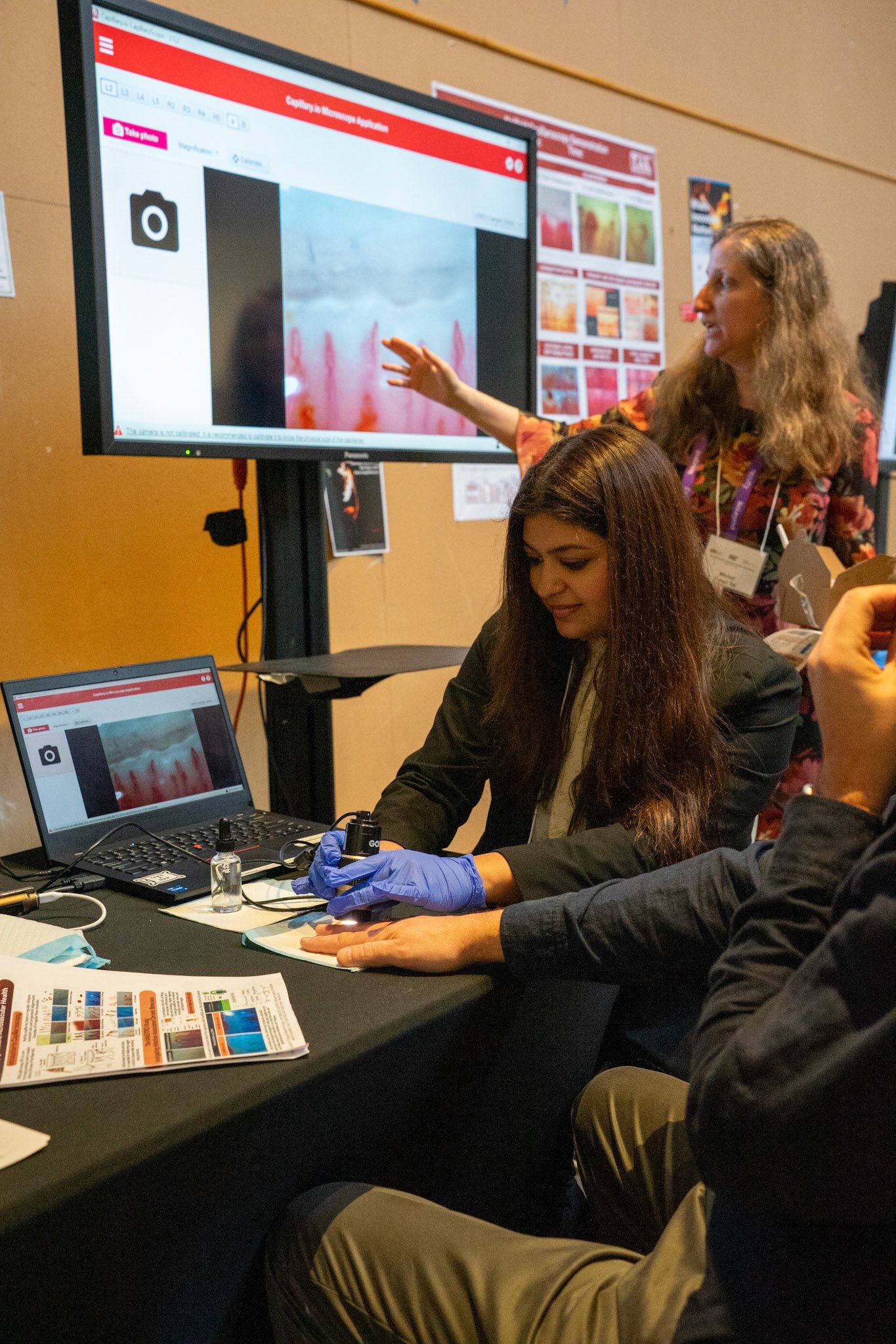 Nailfold capillaroscopy demonstration at MIT using Capillary.io